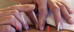acupuntura-em-saquarema-1452382736