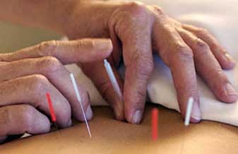 Consultorio de Acupuntura - Foto 1