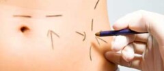 cirurgia-plastica-em-saquarema-1451827061