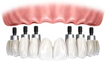 Laboratorio de Protese Dentaria - Foto 1