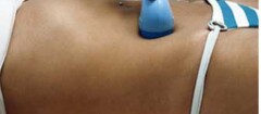 ultra-som-em-saquarema-1452365146